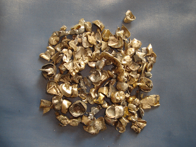 zahngold